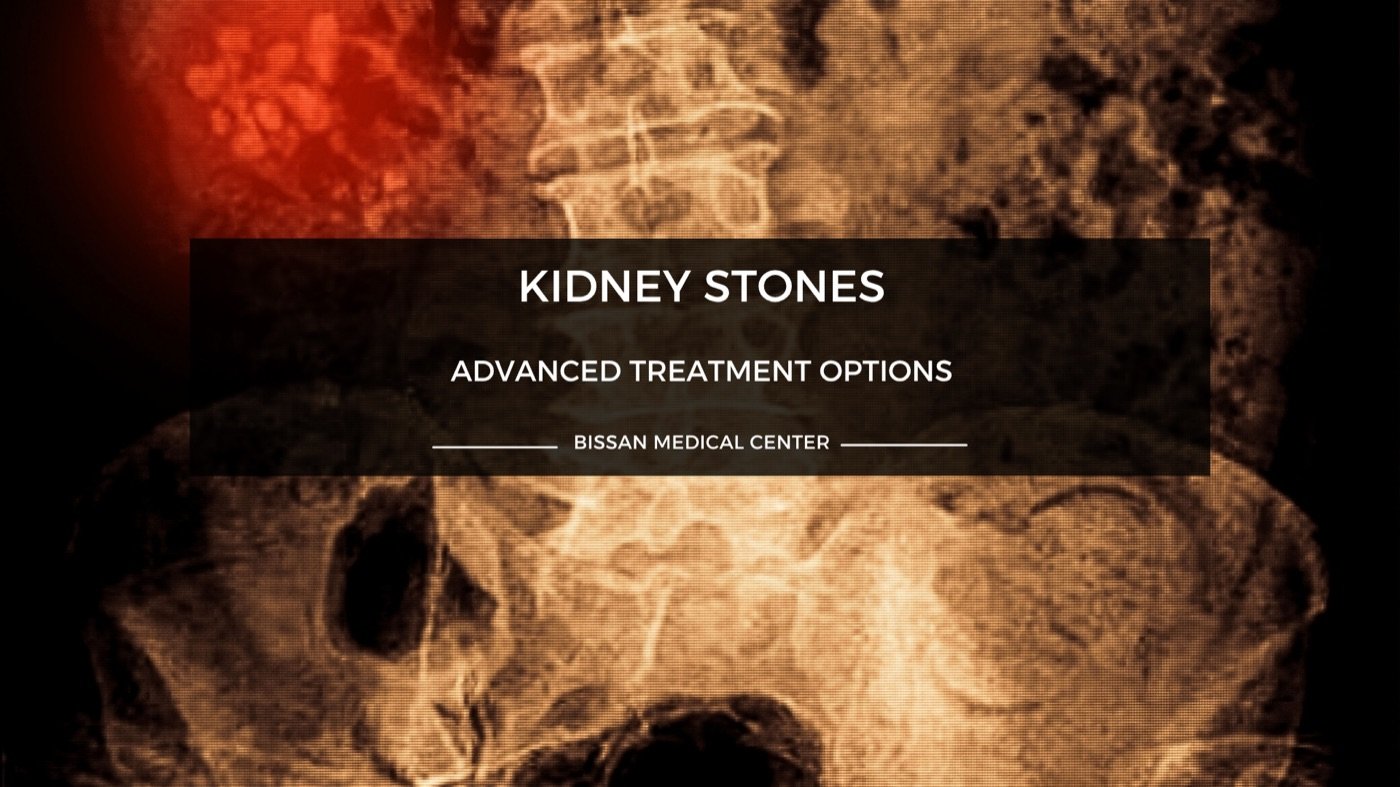 Kidney stone diagnosis and ultrasound at Dr. Nizar's clinic in Sharjah